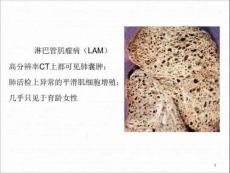 淋巴管肌瘤病的肺部CT表现课件