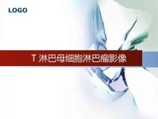 T淋巴母细胞淋巴瘤影像