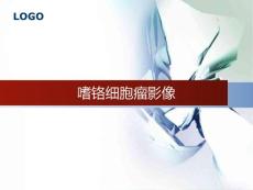 嗜铬细胞瘤影像