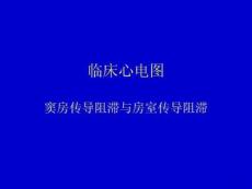 窦房传导阻滞与房室传导阻滞课件