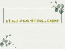脊柱结核转移瘤骨折诊断与鉴别诊断课件