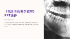 《颌骨骨折教学查房》课件