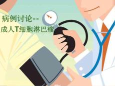 成人T细胞淋巴瘤医学课件