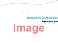 重症肌无力 课件
