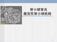 肾小球肾炎继发性肾小球疾病课件
