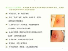 皮肤病与性病课件