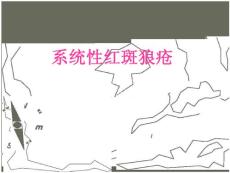 最新 系统性红斑狼疮