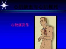心肌缺血心肌梗死课件