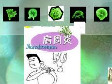 肩周炎
