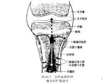 骨髓炎和结核课件