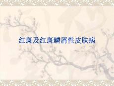 红斑及红斑鳞屑性皮肤病.ppt