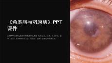 《角膜病与巩膜病》课件
