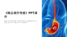 《课件胃癌》课件