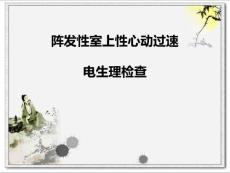 阵发性室上性心动过速.ppt