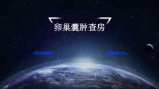 卵巢囊肿查房