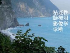 粘连性肠梗阻-影像学诊断课件