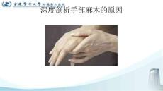 深度剖析手麻的原因课件