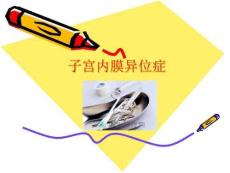 《子宫内膜异位症》课件