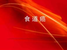 食道癌教课ppt课件