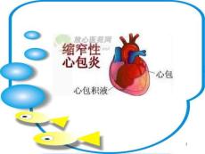 缩窄性心包炎的麻醉.ppt
