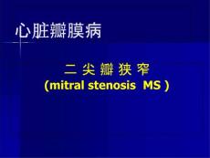 二尖瓣狭窄讲课课件