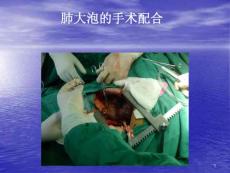 胸腔镜肺大疱切除课件