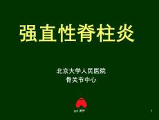 强直性脊柱炎课件