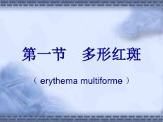 红斑鳞屑性皮肤病powerpoint演示文稿.pptx
