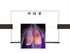 肺栓塞课件