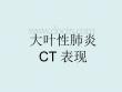 大叶性肺炎PPT课件