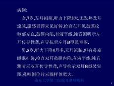 分泌性中耳炎SecretoyotitismediaSOM