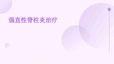 强直性脊柱炎治疗
