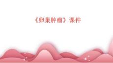 《卵巢肿瘤》课件