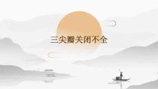 三尖瓣关闭不全