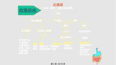 应激性溃疡学习.pptx