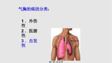 气胸纵隔气肿与肺气肿.pptx