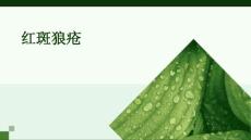 红斑狼疮