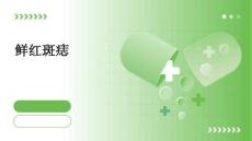 鲜红斑痣