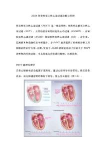2024阵发性室上性心动过速诊断与管理