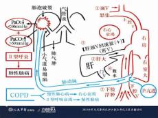 慢性心衰治疗课件
