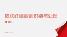 健康课堂之皮肤纤维瘤如何识别和处理