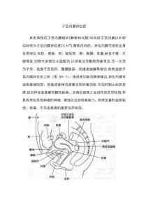子宫内膜异位症