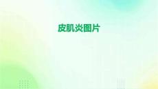 《皮肌炎图片》课件