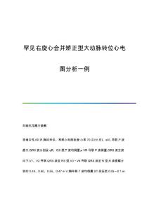 罕见右旋心合并矫正型大动脉转位心电图分析一例