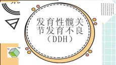 发育性髋关节发育不良