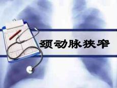 颈动脉狭窄课件