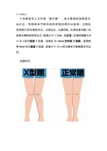 X型腿不用怕，照着做，轻松矫正它！