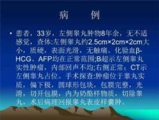睾丸表皮样囊肿PPT课件.ppt