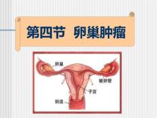 卵巢肿瘤 卵巢肿瘤患者的护理