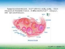 先天性卵巢发育不全综合征课件.ppt